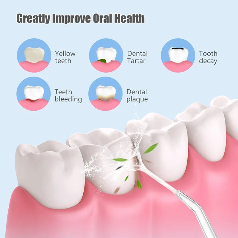 Water Dental Irrigator